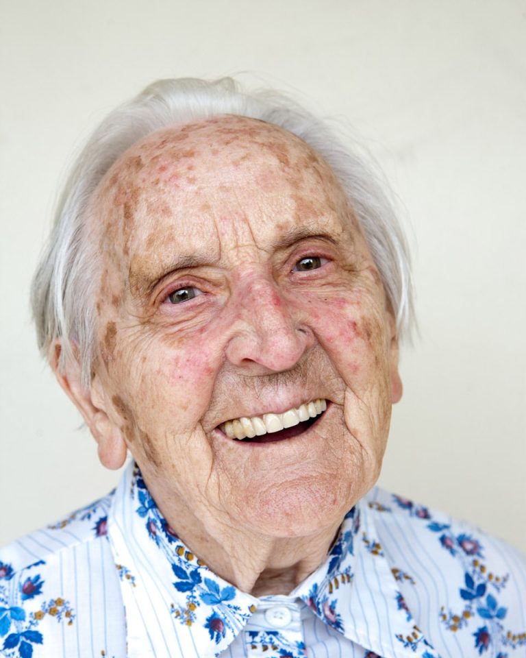 Ouderdomsvlekken dccl man