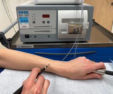 elektrocoagulatie behandeling leeuwarden